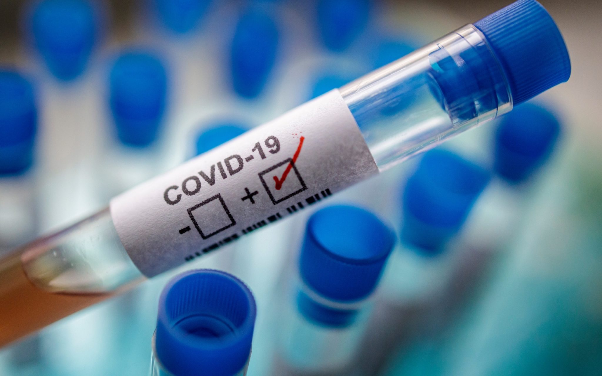 Қарағанды облысында COVID-19 бойынша эпидемиологиялық жағдай